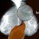 Image for article titled We've Gotten a Little Too Good at Finding Breast Cancer